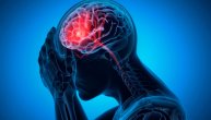 Opasni simptomi moždanog udara koje je lako prevideti, a većina ljudi ih ignoriše: Brza reakcija je ključna