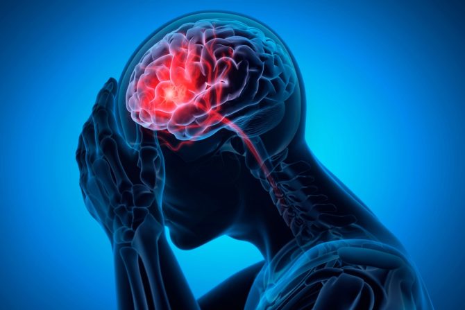 simptomi moždanog udara