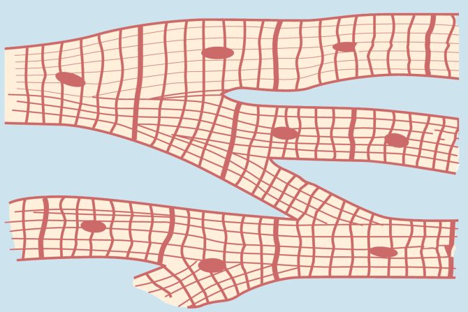 oštećenje srčanog mišića