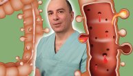 Divertikuloza creva bez simptoma može da postoji godinama: Kako prepoznati bolest priča nam dr Jamal Al Kiswani