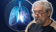 Kada je doktor Vladan dobio epileptični napad, imao je metastaze na mozgu od raka pluća: Sa ovom terapijom živi već šest godina