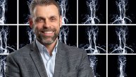 Moždana aneurizma izaziva tegobe tek kada dođe do njenog pucanja, mogu li promene da se uoče na vreme objašnjava dr Bojan Banko