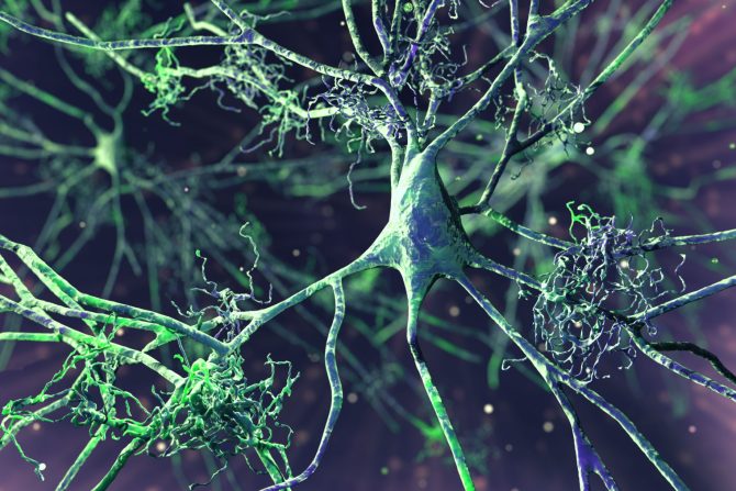 Anti-amiloidne terapije