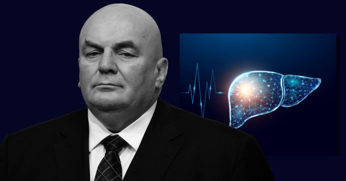 Kako se širi rak jetre i koji su simptomi – bolesti od koje je preminuo ...
