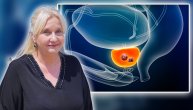 Koliko dugo mogu da žive pacijenti sa rakom prostate ako se bolest otkrije u ranoj fazi, odgovara dr Vesna Stojanović