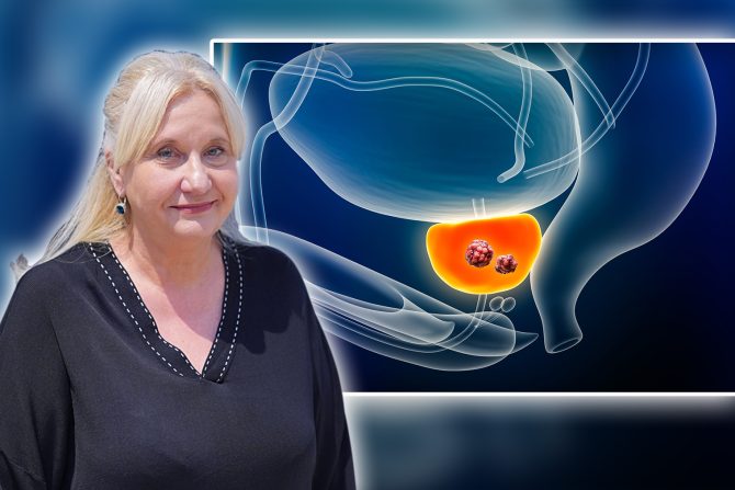 Karcinom prostate Vesna Stanojević