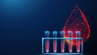 Fibrinogen se sintetiše u jetri, koje su normalne količine ovog proteina u krvi