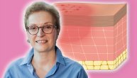 Atopijski dermatitis utiče na razvoj mentalnih stanja pa je psihoterapijska podrška važan deo lečenja, priča nam dr Nives Pustišek