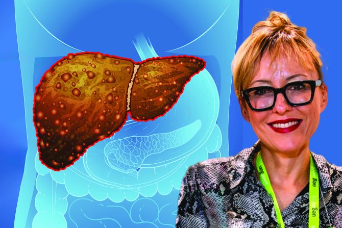 Jetra alkoholna bolest prof dr Tamara Milovanović