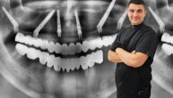 Implantati ili proteza: O novim metodama rešavanja bezubosti priča nam dr Branislav Nadaždin