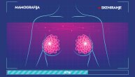 Veštačka inteligencija usavršava predviđanje rizika za pojavu raka dojke na osnovu prethodnih mamografija, tvrde naučnici