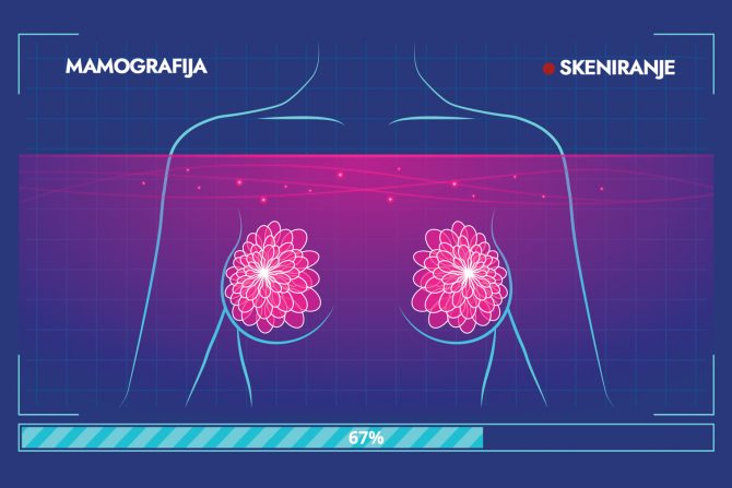 Veštačka inteligencija