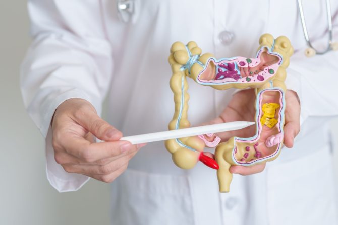 kolorektalni karcinom – rani nastanak