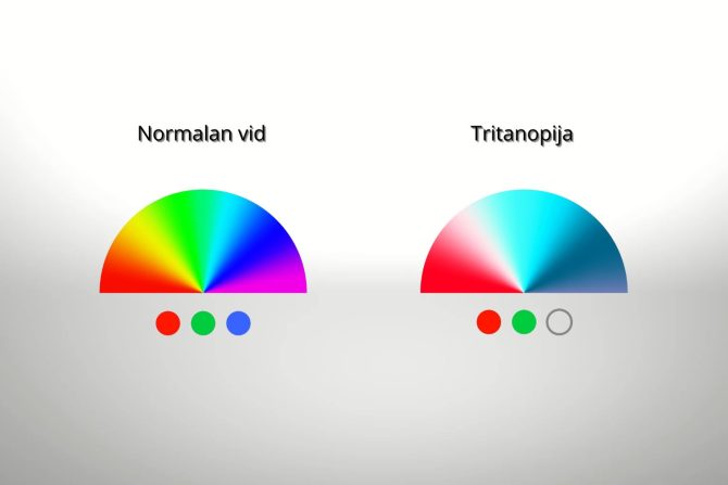 tritanopija