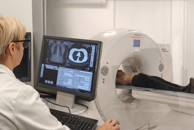 skrining za rano otkrivanja raka pluća