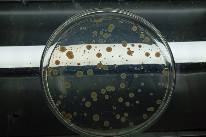 oportunističke infekcije