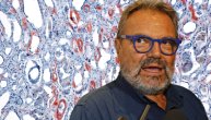 Amiloidoza: Retka ali ozbiljna bolest koja utiče na više organa a od koje je bolovao fotograf Olivijero Toskani