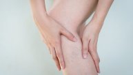 Proširene vene posledica su zadržavanja krvi u venama i više su od estetskog problema. Kako da ih sprečimo?