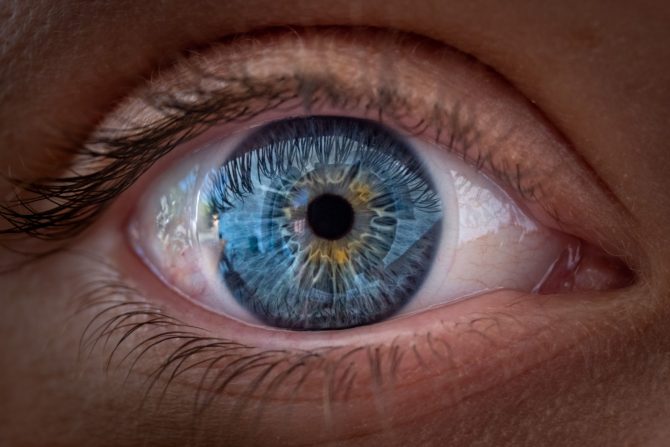 rizik od moždanog udara