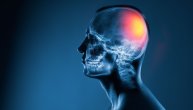 Ozbiljna povreda glave može da probudi „uspavane“ viruse u telu i izazove neurodegenerativne bolesti