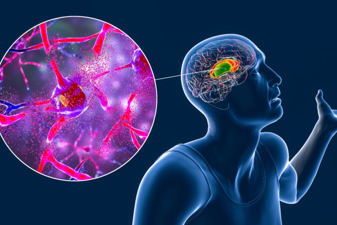 Hantingtonova bolest