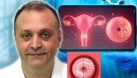 „Mnoge nisu rađale, a imaju već uznapredovali karcinom“: Stručnjak o raku grlića materice koji sve češće pogađa žene mlađe od 30 godina