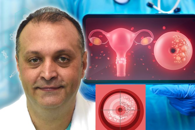 Rak grlića materice