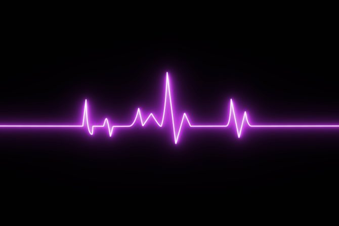 prolaps mitralne valvule