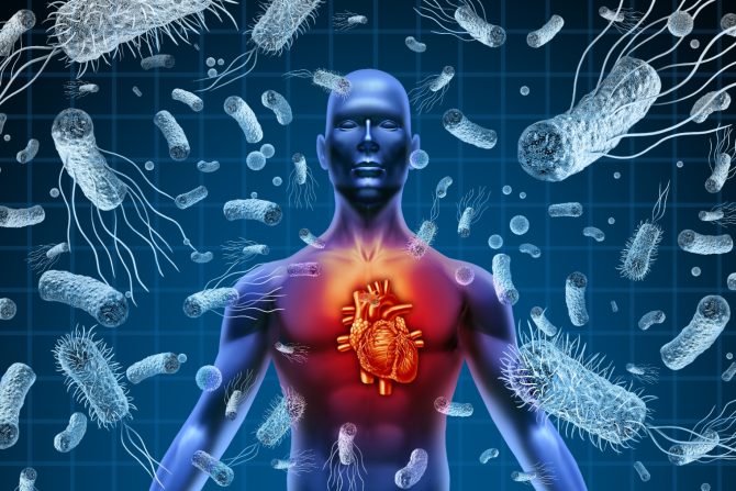 Infektivni endokarditis