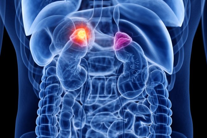 Rak nadbubrežne žlezde