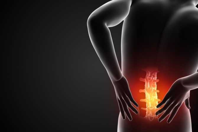 Epiduralne injekcije steroida