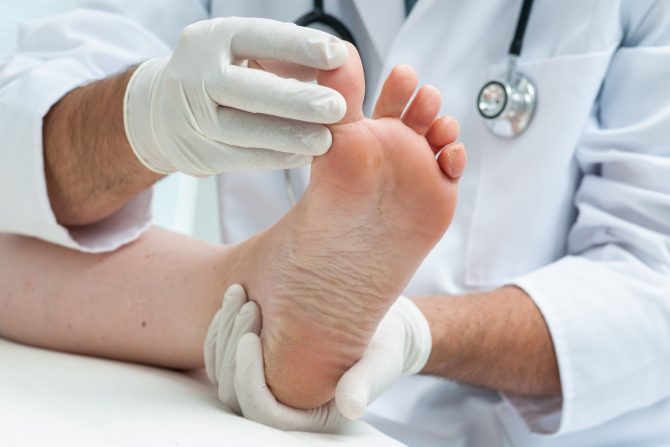 atletsko stopalo i ekcem