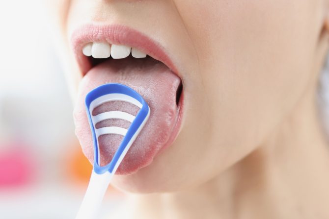 Čišćenje naslaga sa jezika