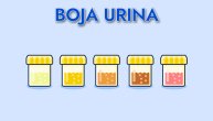 Uočili smo krv u mokraći: Ima li razloga za paniku i šta preduzeti?