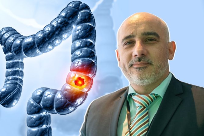 Kolorektalni karcinom