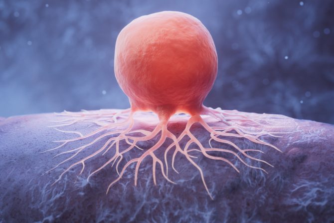 Rak dvanaestopalačnog creva