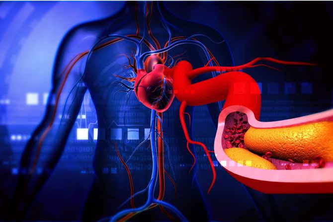 Holesterol i trigliceridi