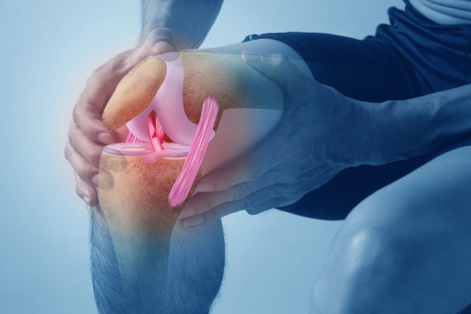 operacija kolena i artritis