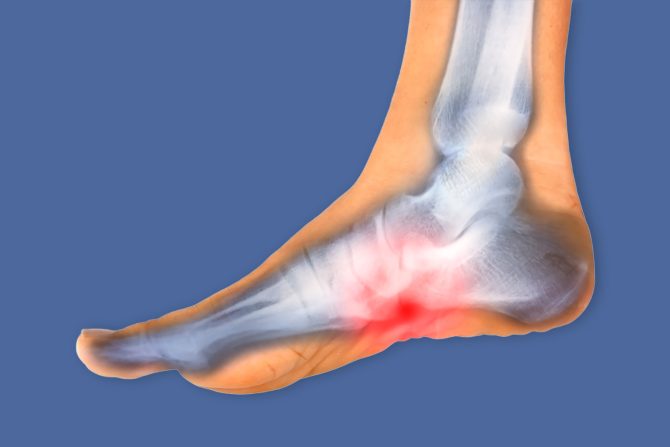 Pametni ulošci za obuću