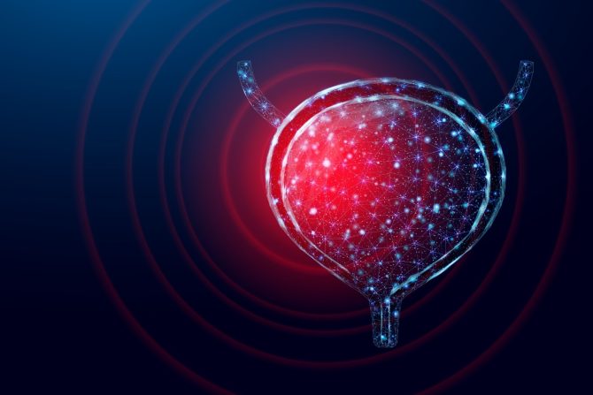 rak mokraćne bešike