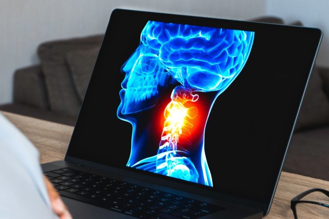 karcinom glave i vrata