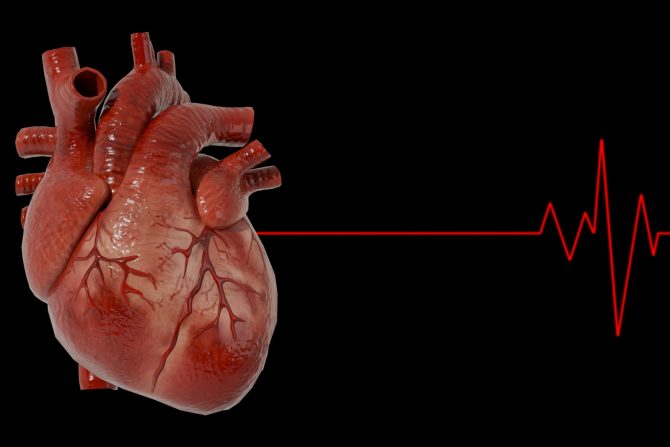nova srčana arterija