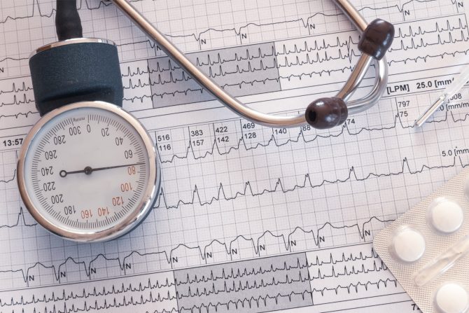 atrijalna fibrilacija