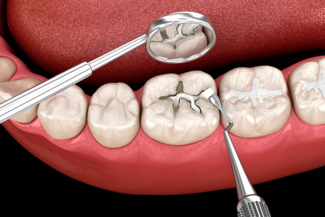Laboratorijski uzgojeni zubi