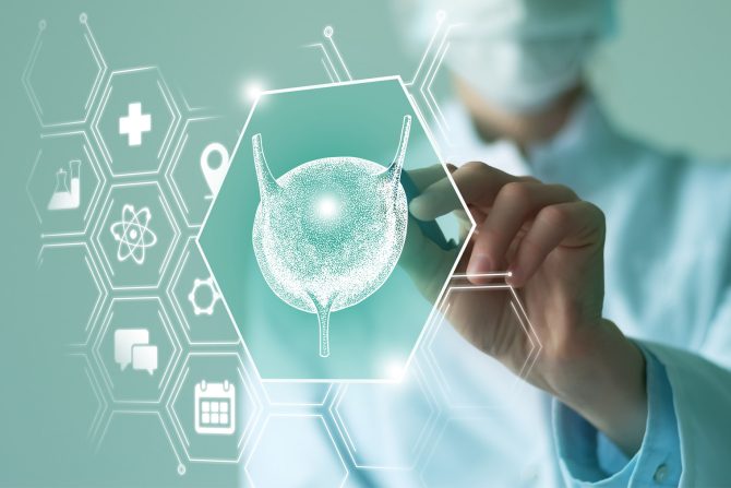 rak mokraćne bešike