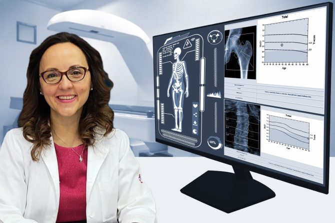 lekovi koji štite od preloma kuka