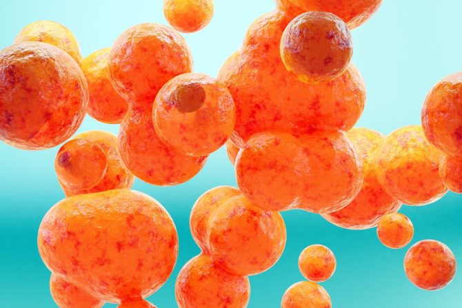 simptom visokog holesterola