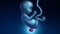 Deca sa defektom neuralne cevi ili hidrocefalusom i njihove porodice ne mogu bez podrške: Važan poziv udruženja HISBAS