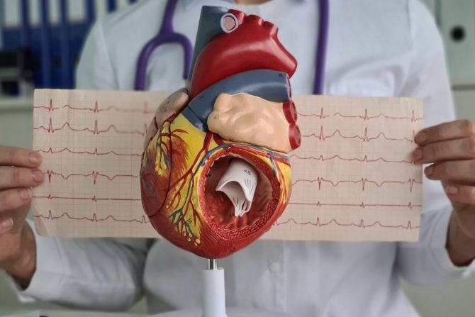 kardiovaskularne bolesti