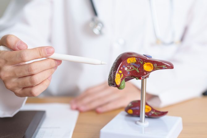 kamen u žučnoj kesi